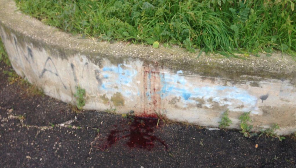 Sangue su marciapiede
