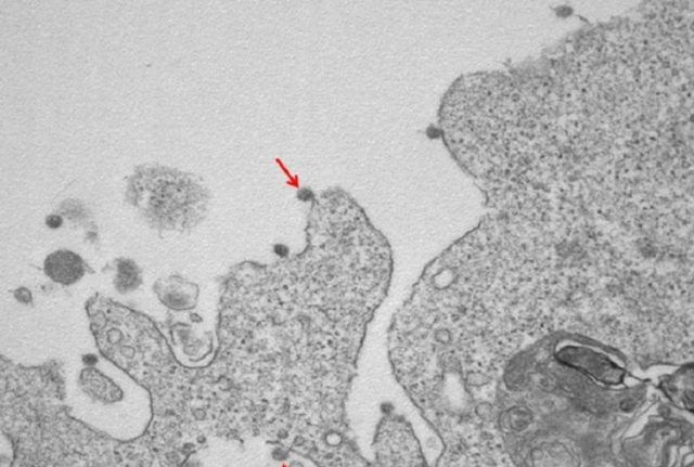 coronavirus