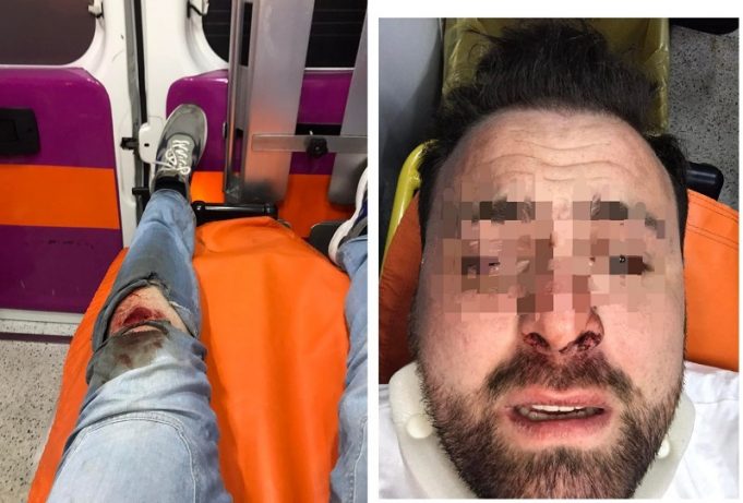 aggressione ponza la vittima 3_08163303