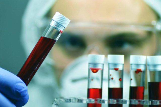 Comuni abitudini che falsano esami e test, medici svelano quali sono