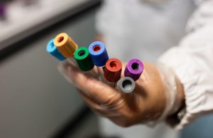 Pubblicato un studio preclinico sull’Indolo-3-Carbinolo contro l’infezione da SARS-CoV-2